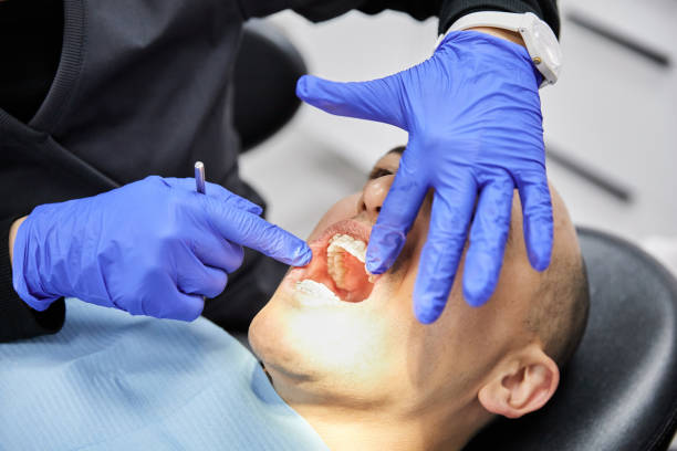 Best Dental Abscess Treatment in Forest Park, OH